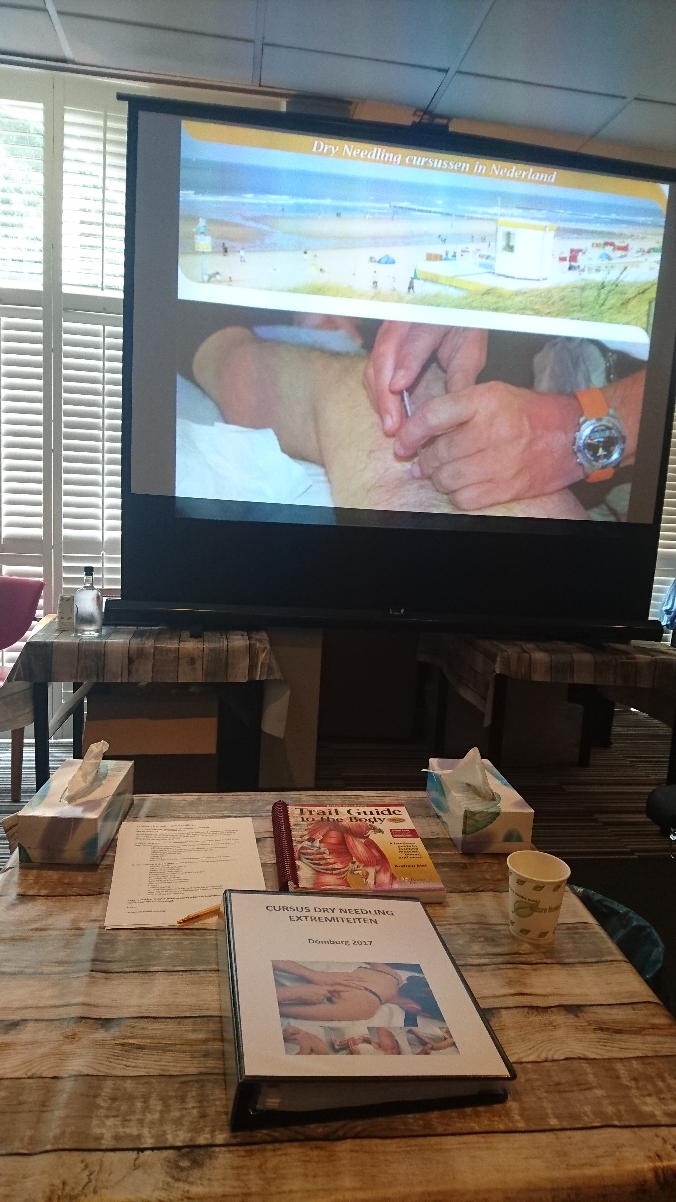 Dry Needling Zoetermeer Dry Needling Zoetermeer