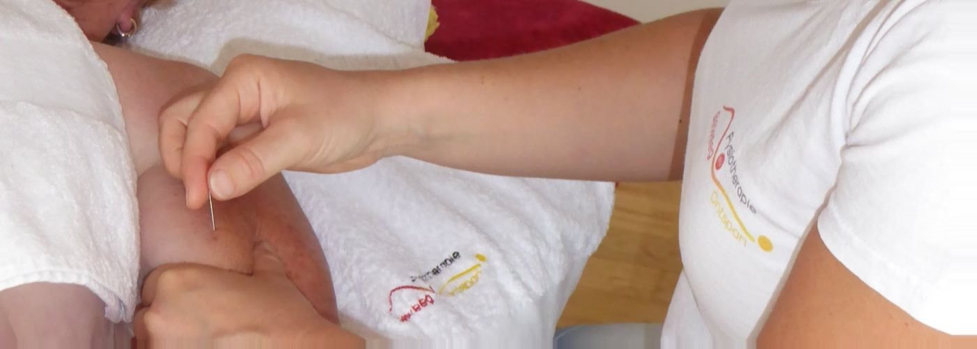 dry-needling-fysiotherapeut-zoetermeer dry-needling-fysiotherapeut-zoetermeer